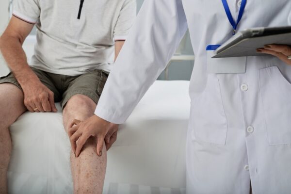Knee-Replacement